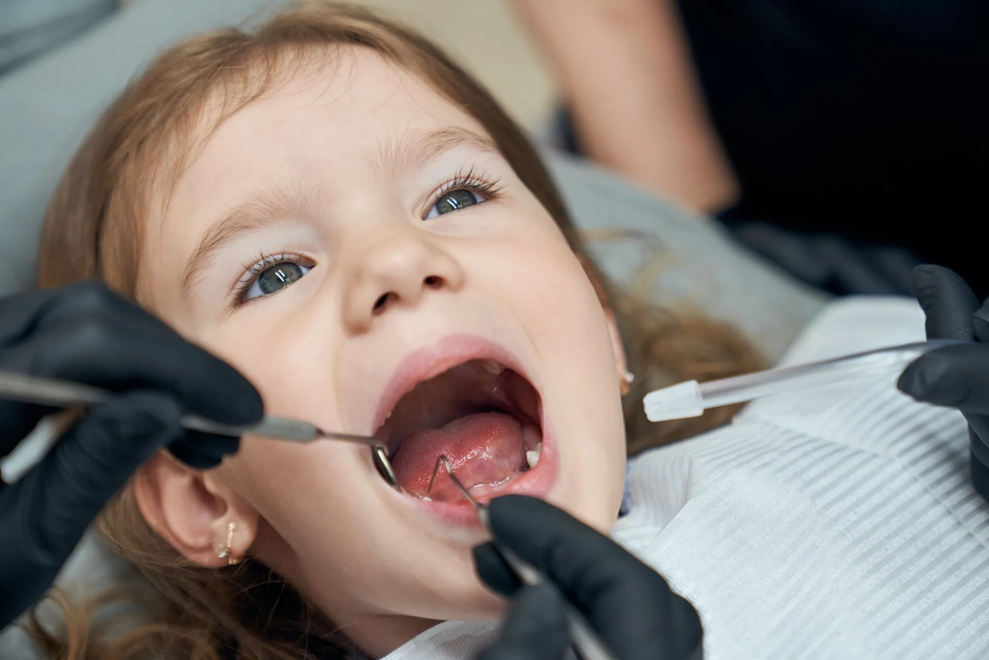 Emergency Dentist Houston | Implants, Dentures, Extractions — Dentistry clinic in Houston, TX — photo 8