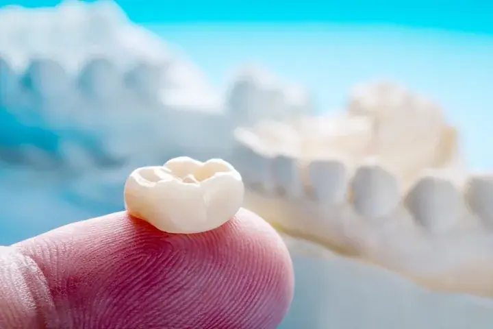 Metal-free ceramic dental crown held next to natural teeth