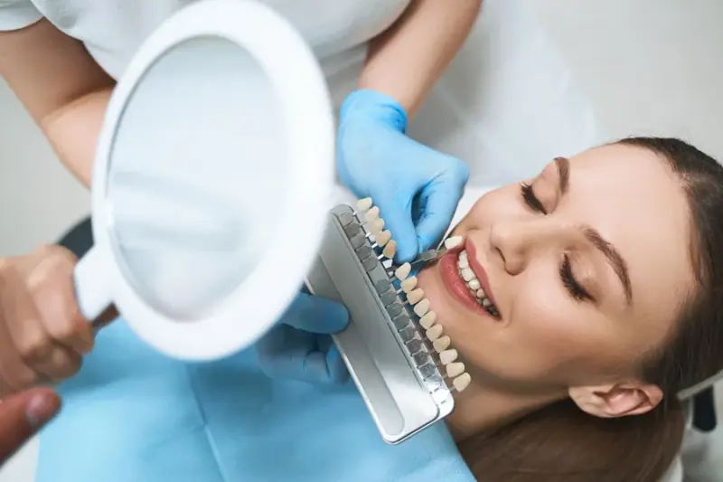 Carillas de porcelana igualadas al tono de la sonrisa de una paciente
