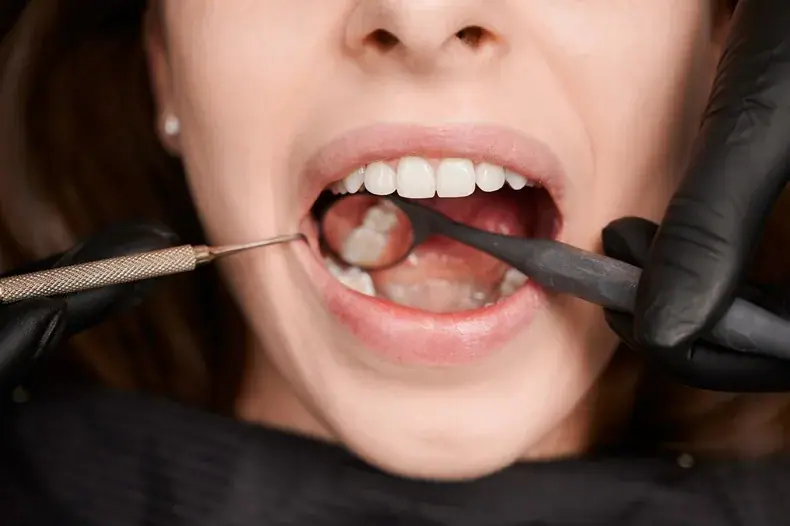 Hồi phục sau khi nhổ răng