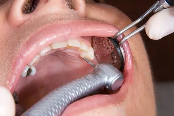 برنامه‌ریزی دقیق بازسازی دهان با ابزارهای دندانپزشکی دقیق در Texas Dental Center.